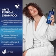 thumbnail image 4 of Champú antifúngico Uttse para la psoriasis del cuero cabelludo, 300 ml, 4 of 5