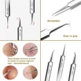 thumbnail image 4 of Fecong Tweezers, Ascoly Tweezers, 2025 New Stainless Steel Blackhead Tweezers, Professional Facial Blackhead Remover Kit, Pore Cleaner Tool, Anti Slip Handle with Storage Box (Set A), 4 of 8
