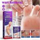 thumbnail image 3 of Corn Removal Extra Strengthen Gel Foot Callus Removal Treatment Hard Skin, 3 of 5