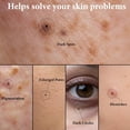 thumbnail image 3 of Pores Dark Spots Cream - Arbutin, Tranexamic Acid, Niacinamide | Targets Spots, Pore Minimizing, Radiant Glow, Gentle Hydrating Formula | Hyperpigmentation Cream for All Skin, 1.76 Fl Oz, 3 of 7