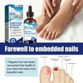 3 Pack Ingrown Toenail Treatment, Ingrown Toenail Removal Kit, Ingrown Toe Nail Correction