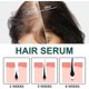 thumbnail image 2 of Dense Hair Essence Anti-Hair Loss Mild urishing Hair Root Strong Hair Care Plant Essence, 2 of 4