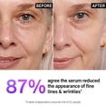 thumbnail image 3 of Sérum The INKEY List con 1% de retinol de liberación lenta, 30 ml, para todo tipo de piel, 3 of 7