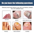 thumbnail image 4 of Antifungals Nail Treatments Spray In Medicals Quality, 30 Ml, Antifungals Nail Treatments, Antifungals Spray 30ml, 4 of 5