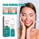 thumbnail image 2 of Clearance Sale! 20ml Scar Remover Spray Pimples Stretch Marks Scar Gel Smoothing Body Skin Care Promote Cell Regeneration Spray (Buy 2 get 1 free), 2 of 9
