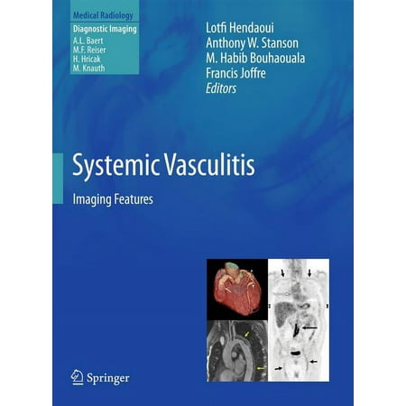 UPC: 9783642024832 | Systemic Vasculitis: Imaging Features (Hardcover)