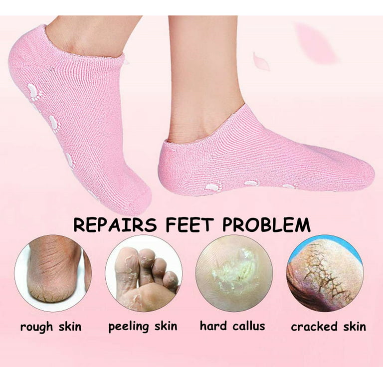 Gel Socks Moisturizing Socks,Soft Spa Socks For Repairing and Softening Dry  Cracked Feet Skins, Gel Lining Infused with Essential Oils and Vitamins  (Black & Grey) 