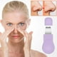 thumbnail image 2 of Herramienta para el cuidado facial: Pala para puntos negros, herramienta para el cuidado profundo de los poros, 2 of 6