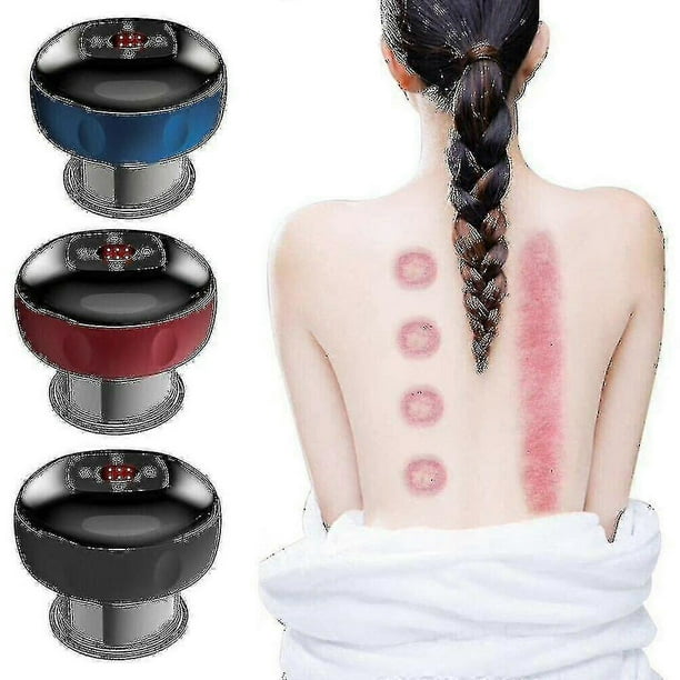 Smart Cupping Therapy Massager With Red Light Therapy Electric Cupping Massage Device For Black- Aespa