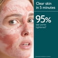thumbnail image 3 of Mascarilla de arcilla Caudalie Instant Detox Minimizador de Poros 30 ml, 3 of 7