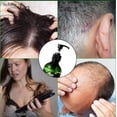 thumbnail image 6 of 3 in 1 Jamaican black castor oil + Amla Oil + Black seed oil (Shampoo and Conditioner), 6 of 7