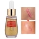 thumbnail image 5 of Suero Para Las Estrías, Crema Para El Cuidado De La Piel, Tratamiento Para Eliminar Las Estrías De Las Cicatrices, Suero Para Reparar La Piel Dañada, Líquido Suavizante, 20ml ANGGREK Otros, 5 of 8