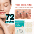 thumbnail image 2 of 72 Parches Invisibles Cubre Acne Espinillas Granos Facial, 2 of 7
