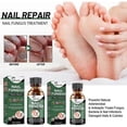 thumbnail image 2 of 1-3pcs Extra Strength Nail Repair Fluid Toenail And Nail Solution Toenails And Nails Repair Damaged And Discolored Nails new, 2 of 4