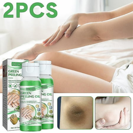 30ml Green Peeling Oil Body Dark Skin Exfoliating, Whitening Softening Callus Removal 1/2pcs