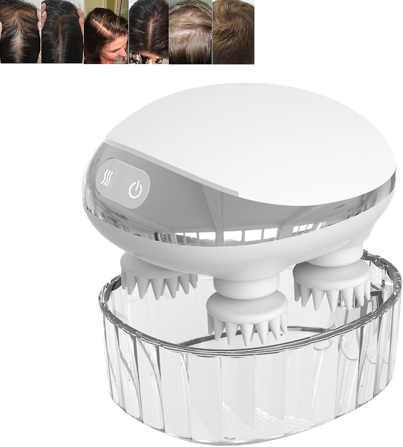 Smart Scalp Massager, Hair Growth Massager, Electric Jamaica | Ubuy