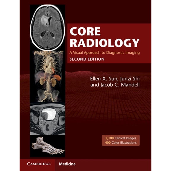 Core Radiology: A Visual Approach to Diagnostic Imaging, (Paperback)