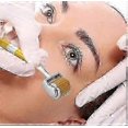 thumbnail image 4 of Scalp roller, 1 piece, painless and easy to use for stimulating hair growth, 4 of 5