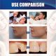 thumbnail image 3 of Silicone Dental Mouth Guard Bruxism Sleep Aid Night Teeth Tooth Grinding, 3 of 5