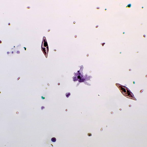 Mixed Protozoa, W.M. Microscope Slide