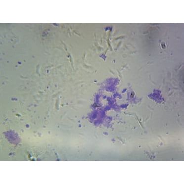 Streptococcus Pneumoniae (Diplococcus); Smear; Gram-Positive by Go Science Crazy