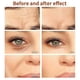 thumbnail image 5 of Masajeador facial de pulso de oro de 24 quilates Beauty Bar, herramienta de masaje facial vibratorio eléctrico portátil en forma de T para pieles sensibles, 5 of 5