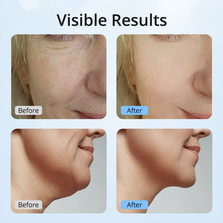 Mieauty 7-Color LED Anti Aging Skin Care Tool, Facial/Neck Lift &  Tightening Wand, White - Walmart.com