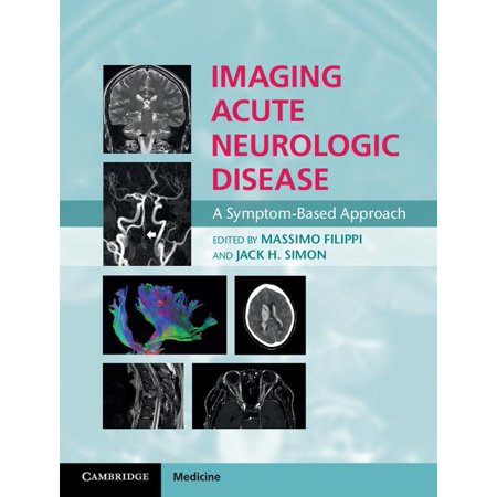 ISBN 9781107035942 product image for Imaging Acute Neurologic Disease : A Symptom-Based Approach (Hardcover) | upcitemdb.com