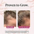 thumbnail image 4 of Hair Growth Supplements for Women, Thicker Fuller Hair Support for Thinning Hair and Hair Loss, 4 of 5