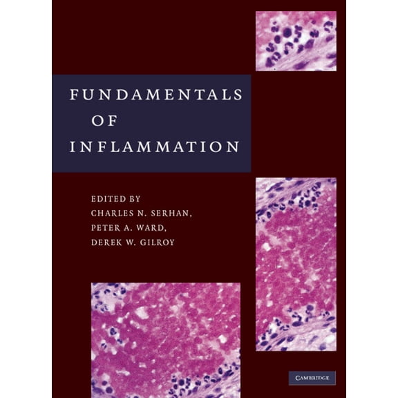 Fundamentals of Inflammation, (Hardcover)