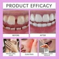 thumbnail image 2 of New Jeremytis Thermoplastic Denture Adhesive,Jeremytis Denture Adhesive, 2 of 5
