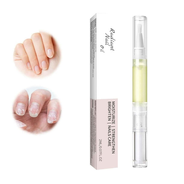Fiudx Acetato para Uñas, Vitamina E, Vitamina E, Origen Vegetal, Nutritivo para Cortes, Repara Uñas, Us Diario para Todo Tipo de Uñas, 2 Ml, Tamaño Ideal para Viajes