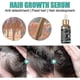 thumbnail image 3 of Jaysuing Dense Hair Essence Repair And Moisturize Dry Hair To Prevent Dense Hair, 3 of 5