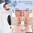 thumbnail image 2 of Blackhead Remover Pore Vacuum Facial Pore Cleanser, 2 of 5