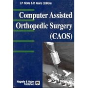 CAOS - Computer-Assisted Orthopedic Surgery