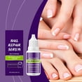 thumbnail image 1 of Líquido reparador de uñas Nutre profundamente las uñas Mejora la dureza Reduce la rotura y repara el daño 10 ml Líquidos de enfermería, 1 of 9