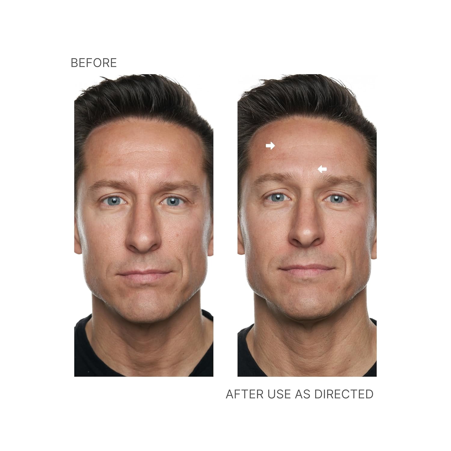Nu Skin Face Lift with Activator, Original Formula, Instant Facial Firming and Tightening Treatment for Face and Neck, Reduces Fine Lines and Wrinkles, Enhances Skin Tone and Texture