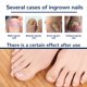 thumbnail image 4 of Qarigey 50 unids/caja parche para uñas de los pies impermeable pegatina encarnada herramienta transpirable Arte de uñas, 4 of 6