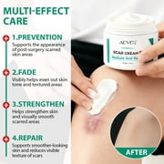 Scar Cream for Older Scar & New Scar, Scar Removal Cream for Scars, Burns, Stretch Marks, 50ml