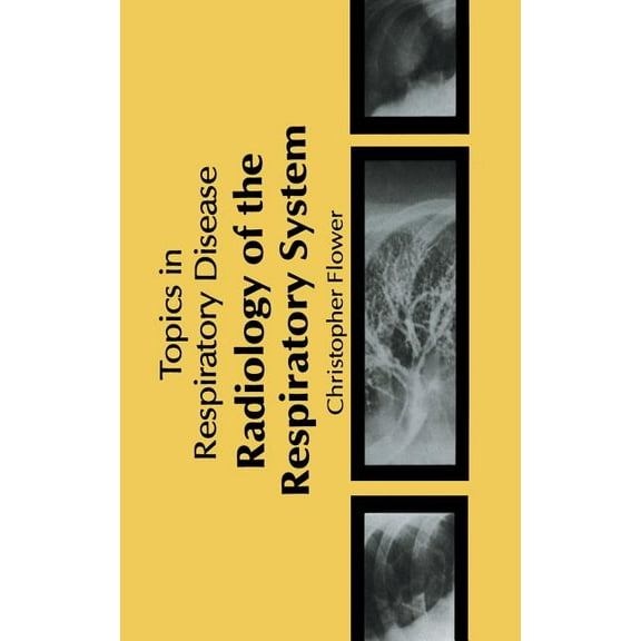 Radiology of the Respiratory System, (Paperback)