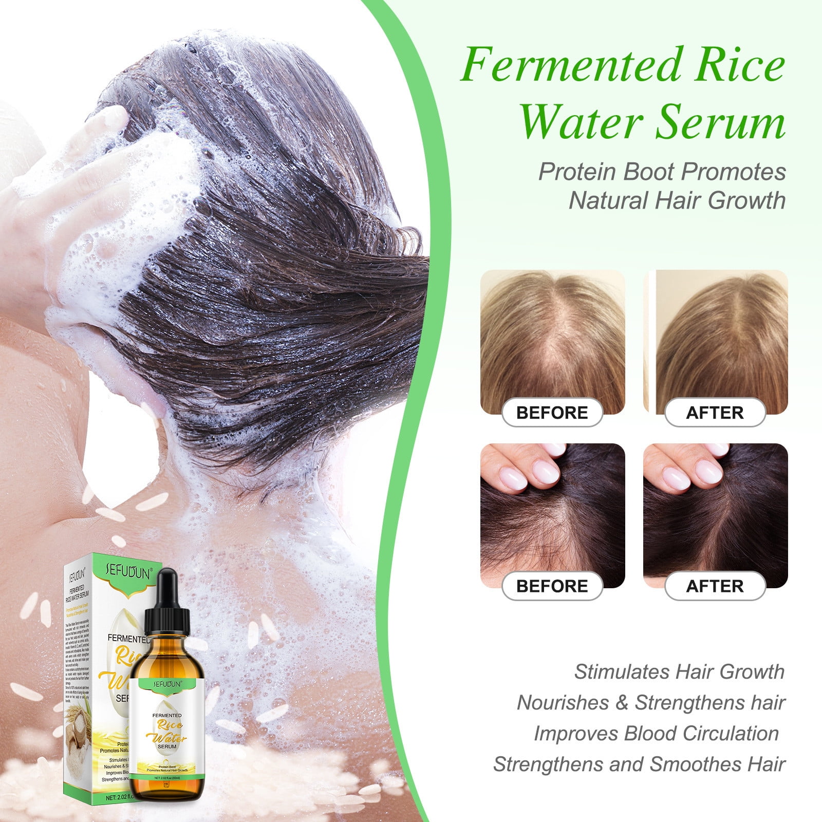 Fermented Rice Water Essence, Rice Water Hair Growth Essence, Hair Growth  Rice Water, Hair Loss , Hair Thinning Assist, Hair Regrowth 