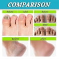 thumbnail image 4 of Ouhoe 3 piezas Spray para eliminar el mal olor de los pies | |, 4 of 4