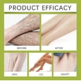 thumbnail image 4 of Cyperus Rotundus Oil Topical, 100% Nut Grass Oil, Cyperus Rotundus Oil For Removal, Cyperus Rotundus Oil Reducing, 4 of 5