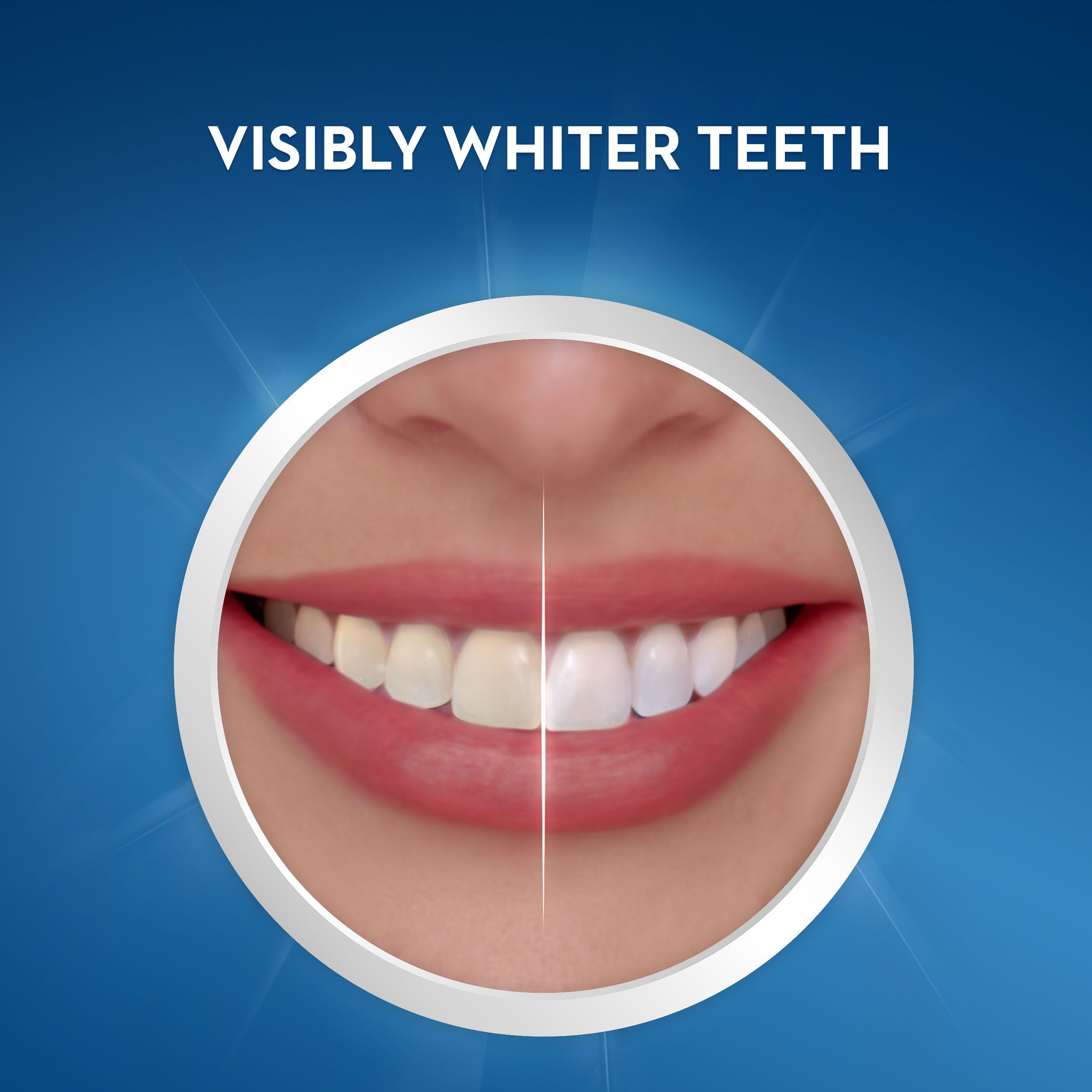 Crest Noticeably White Whitestrips Teeth Whitening Kit photo 4