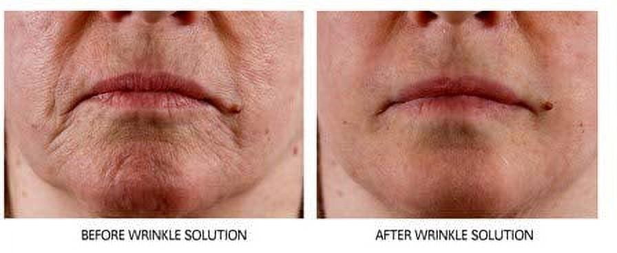 Dr Sevinor Genuine-Original Amazing Wrinkle Solution Wrinkle Smoothing Tinted Serum 1fl oz As Seen on TV!