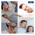 thumbnail image 4 of 90PCS Anti-Snoring Mouth Patch For Reduce Mouth Breathing Closed Mouth Patch Improve Sleeping Quality, 4 of 5