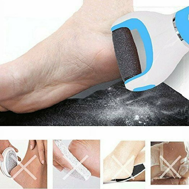 Electronic Foot File Callus Remover: Pedicure Tools Scrubber Kit