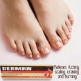 Derman Antifungal Cream. Athlete's Foot, Ringworm and Jock Itch