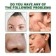 thumbnail image 3 of Mascarilla de arcilla de té verde contra el tratamiento del acné facial Eliminador de espinillas Cuidado de la piel Ndcxsfigh  Cuidado Belleza, 3 of 4