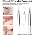 thumbnail image 3 of MRSXXNTY Professional Pimple Popper Tool Kit - 22 PCS Blackhead Remover Tools for Acne and Zit Popping Comedone Extractor with Magnifying Glass and Alcohol Pad, 3 of 5